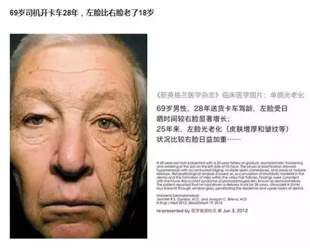 女人过了45，建议出游戴帽子，既减龄还防晒，清新优雅气质撩人