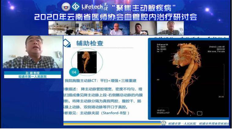 血管腔内治疗研讨会,主动脉疾病治疗研讨班