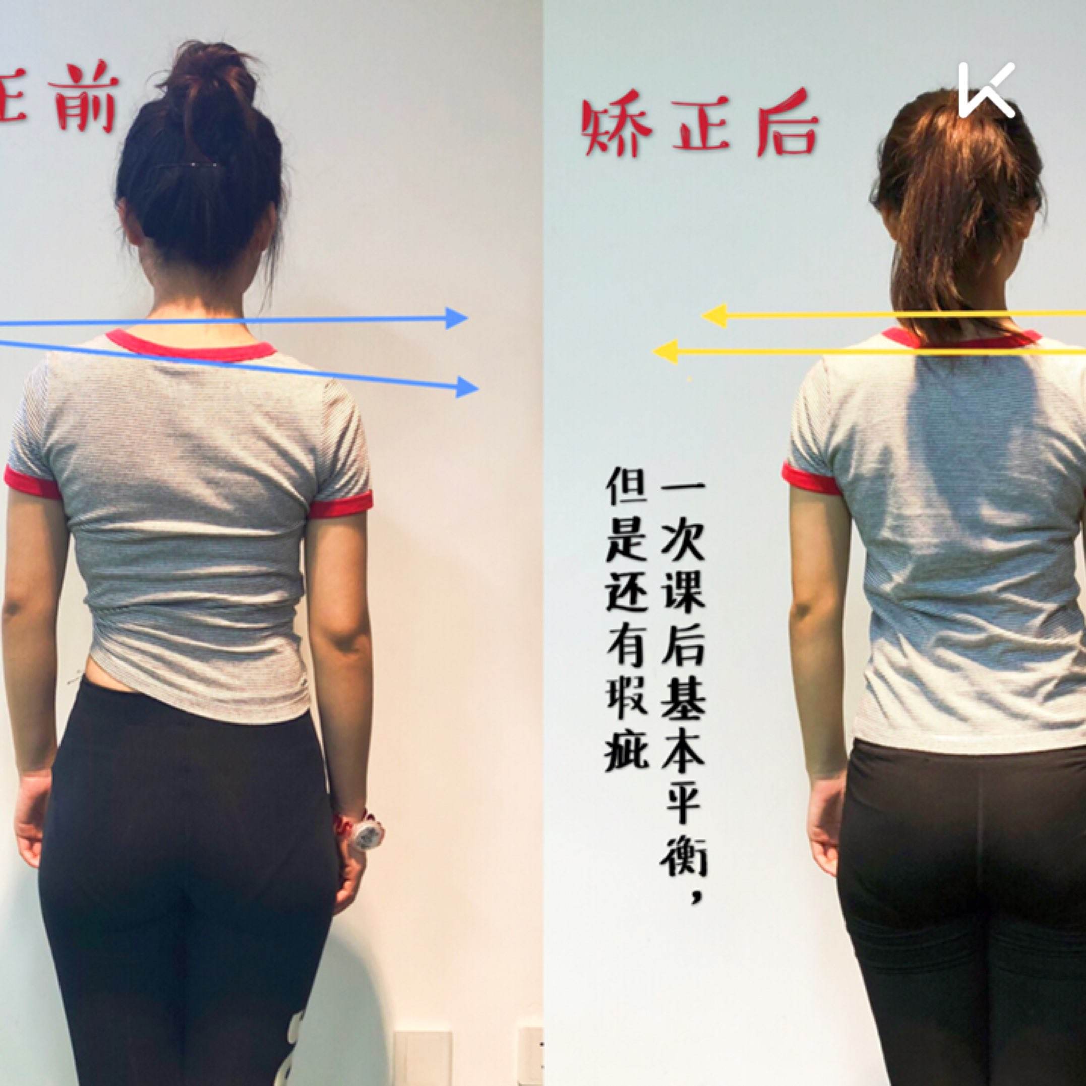 毁气质的高低肩,2招变成天生“衣架子”,练它