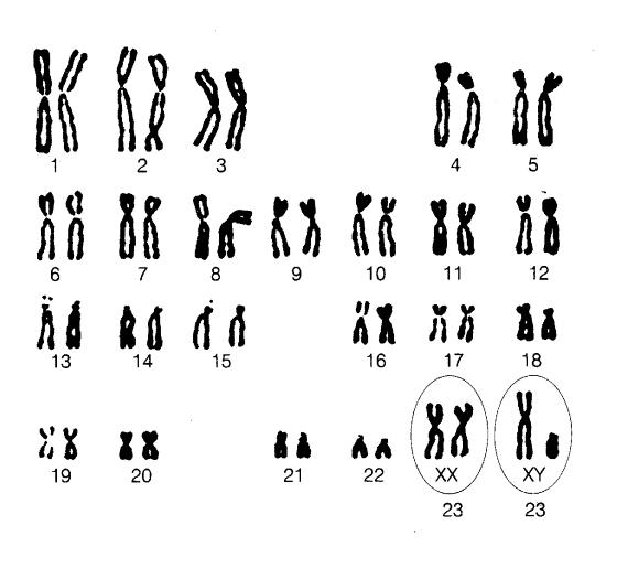 【呱呱教·114】【优生】二胎时代，高龄产妇增多，你需要了解染色体病