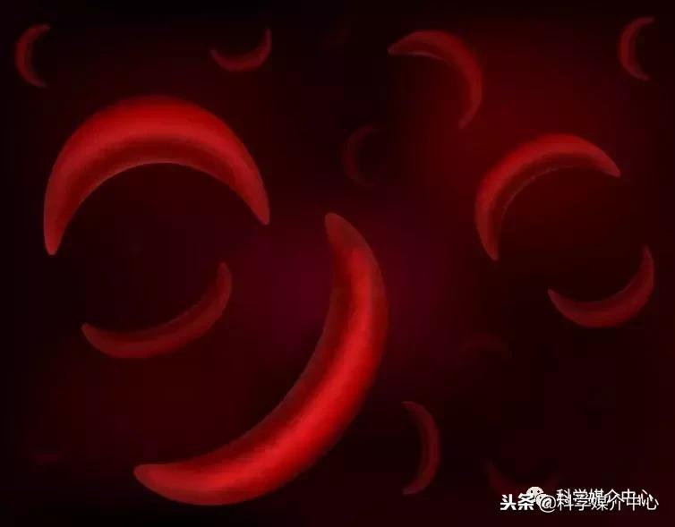 感染疟疾的红细胞的形状,镰刀型红细胞与疟疾的关系