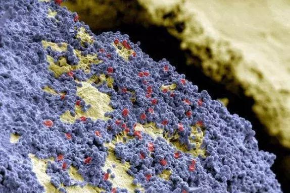 我国口腔问题不容忽视,口腔问题严重吗