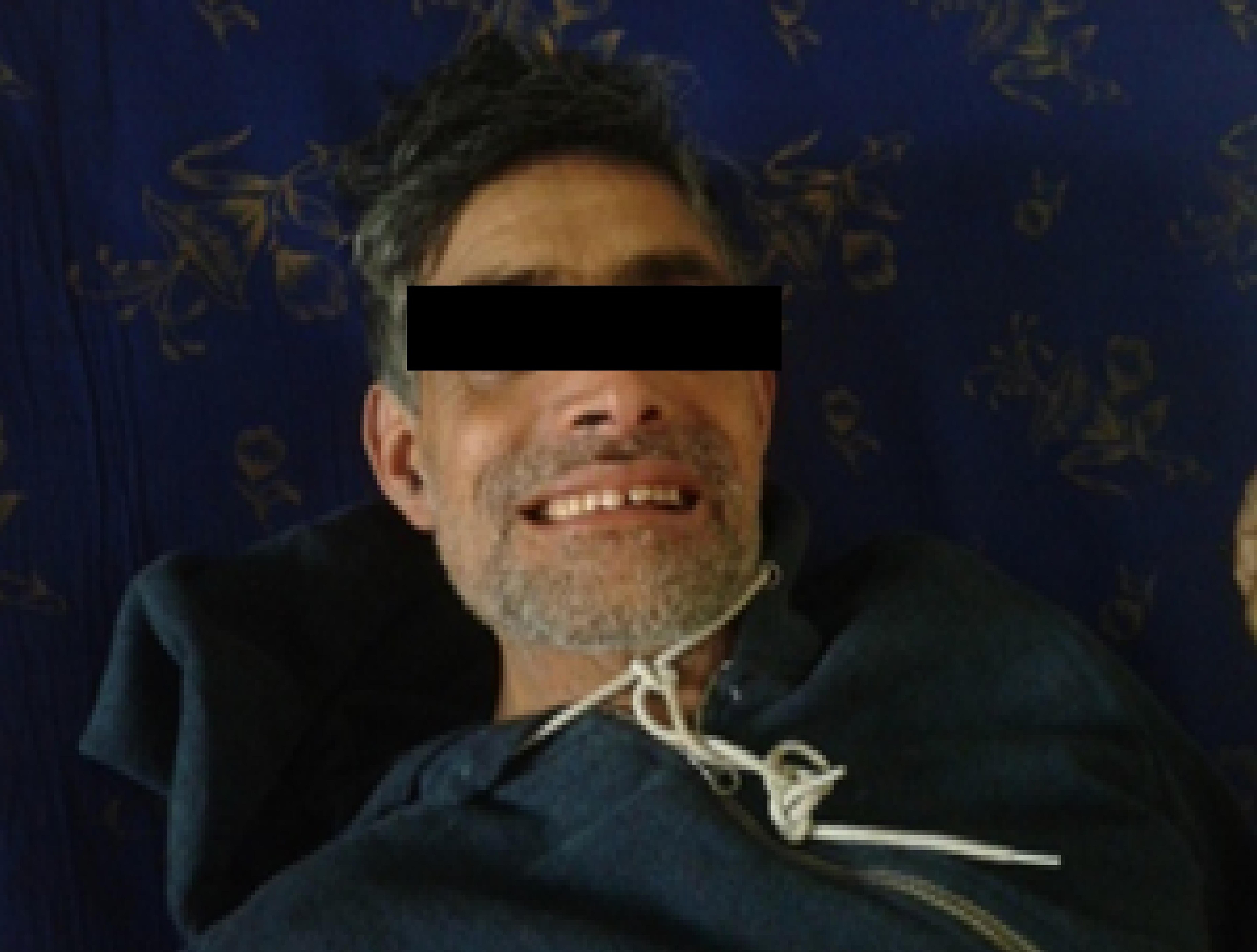 竹签刺破了手指要不要打破伤风针,竹签刺到会得破伤风吗