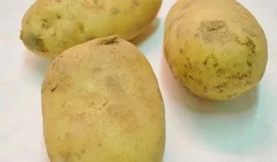 尿素偏高是肾功能不全吗,肾功能检查尿素略高