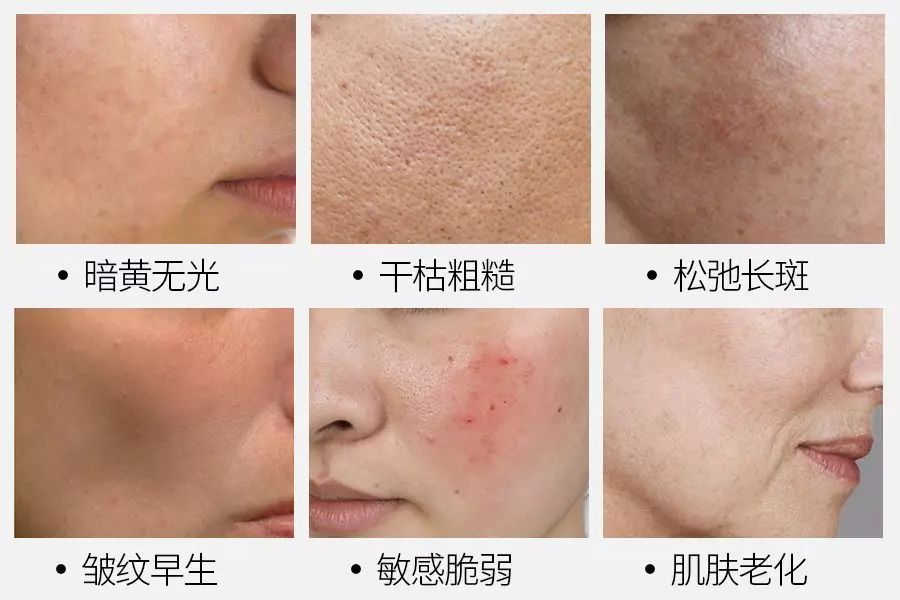 李小冉皮肤嫩白,李小冉肌肤白到发光