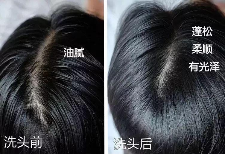 去头屑去螨虫哪个洗发水最有效,去头屑去螨虫用哪个洗发水最有效