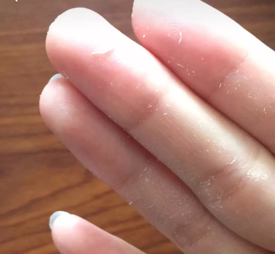 爱出油还起皮用什么粉底液,爱出油的皮肤怎么办