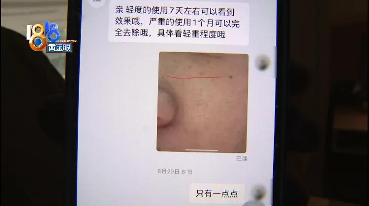 化学药物点痣留下疤,皮肤抑菌膏祛痣