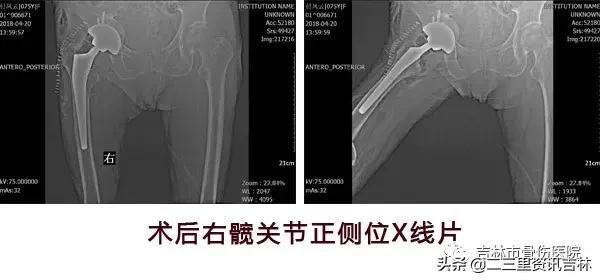 从医30余年，他治疗数以万计骨伤骨病患者