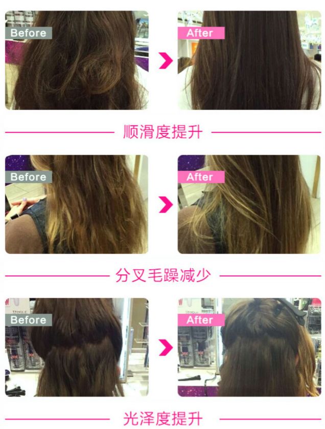 雄性激素脱发怎么自救,自救脱发最有效的方法