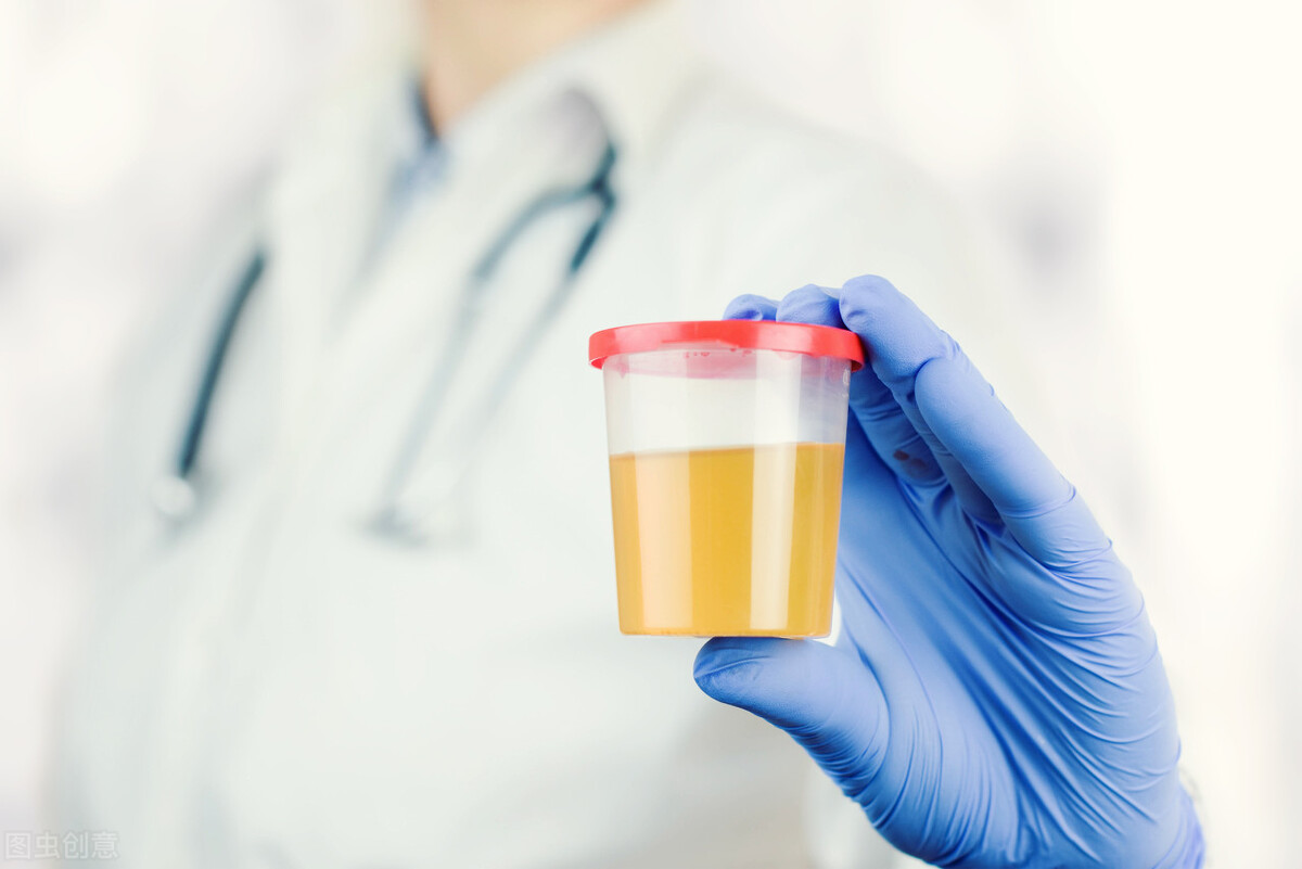 尿常规大部分人都做错了，想要准确的检测结果就要选择这样留尿