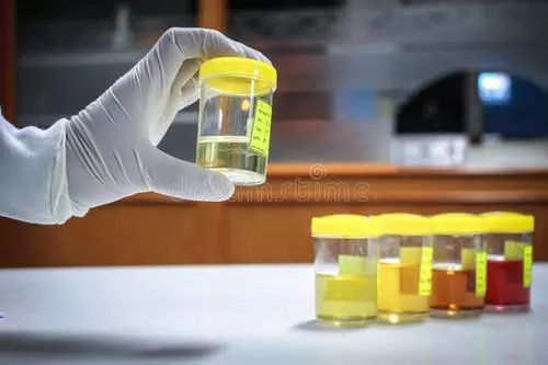 腿毛可以检测吸毒么,一根头发可以检测吸毒了吗