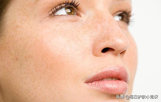 淡斑改善皮肤暗黄,皮肤怎样补水淡斑