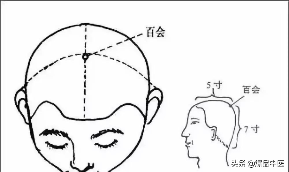 中医针灸睾丸坠痛特效穴,消除疼痛十大特效穴图解