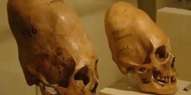 澶栨寕鐜勫够灏忚,澶栨寕鐭瘒灏忚