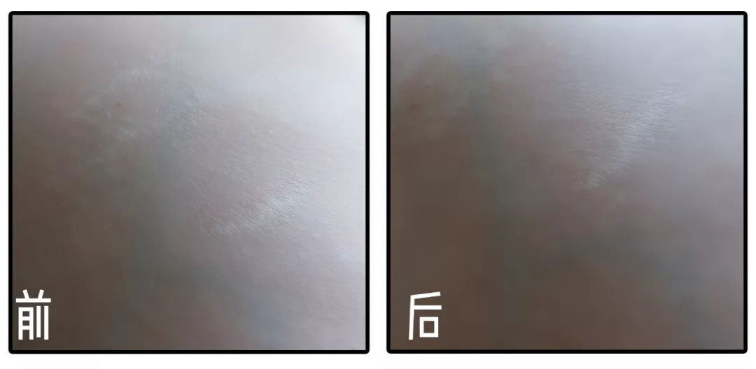 精油入门必备护肤品,平价单方精油推荐面部