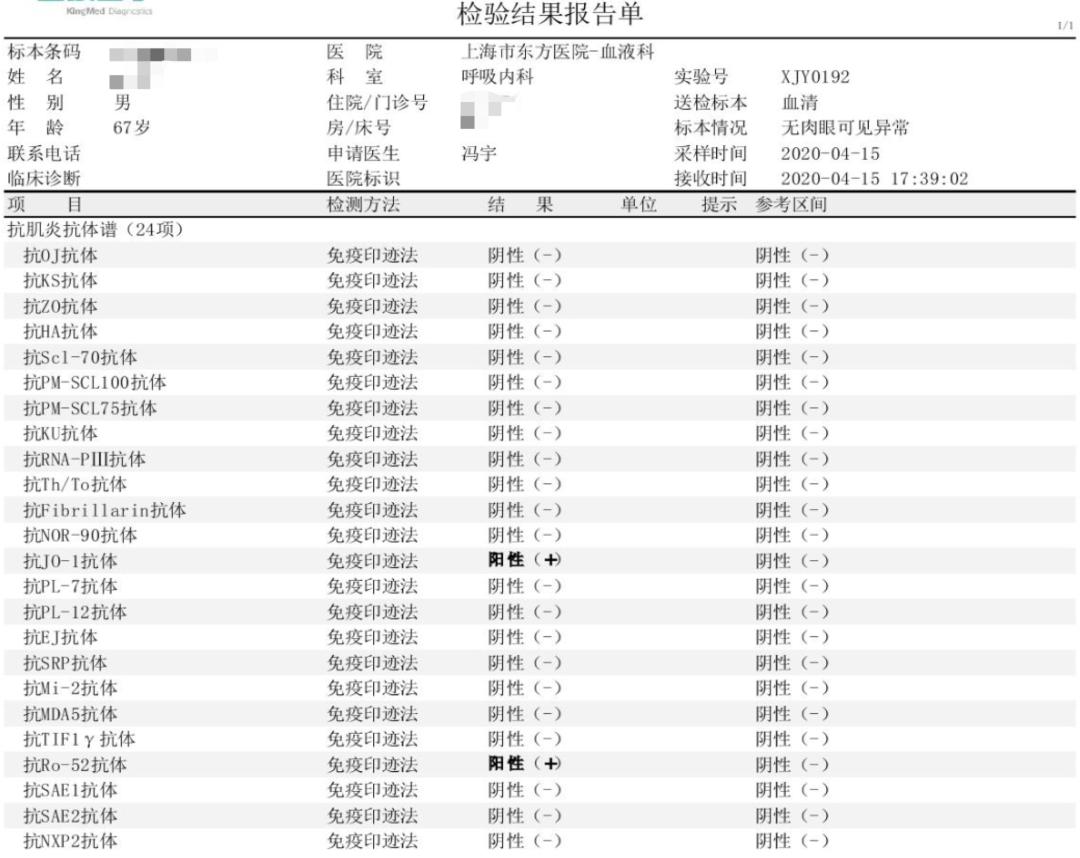 抗合成酶综合征是肺纤维化吗,抗合成酶综合征体征