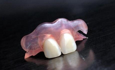 做一颗临时牙教程,自制隐形牙