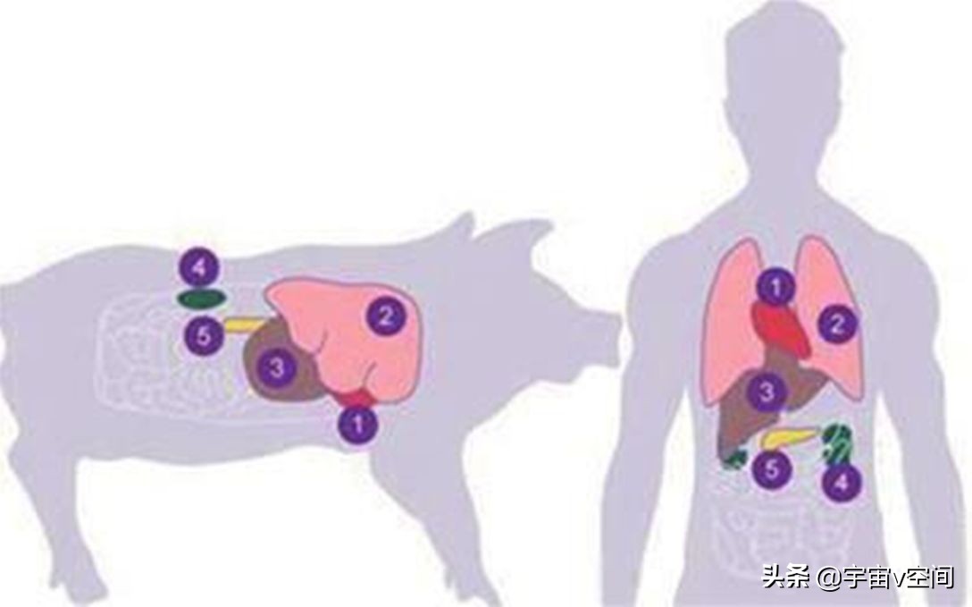 美国猪肾移植人体实验,美国科学家猪肾移植人体实验成功
