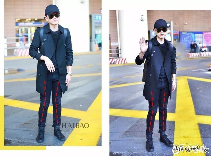 改善x型腿最有效的方法,x型腿的快速矫正方法