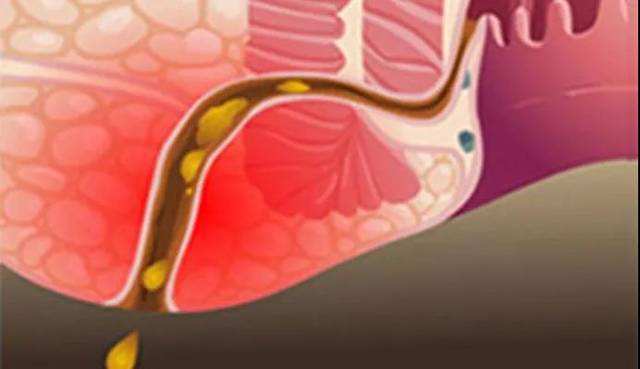 别人坐过的热板凳能立即去坐么,别人坐过的热凳子会有传染病吗