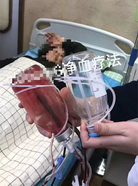 那些坑爹的网红减肥方法大揭秘,跟着女明星吃东西变美