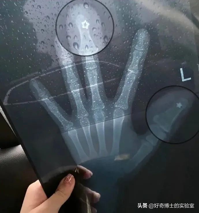 手机进水放进米缸里真的管用吗,手机进水放进米缸有用吗