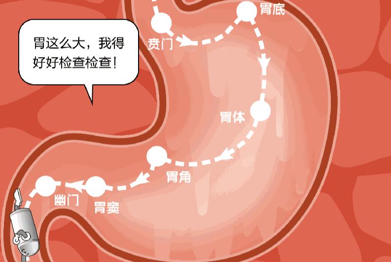 我国首创胶囊机器人，开辟新一代胃镜检查系统，为大国科技点赞