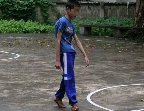 幼猫走路外八字怎么纠正,纠正内八字的训练方法