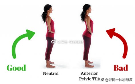 膝内旋矫正,如何改善膝盖反弓