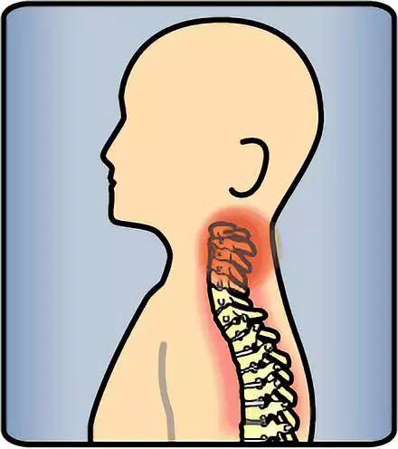 落枕怎么恢复锻炼,如何缓解落枕疼痛的5种方法