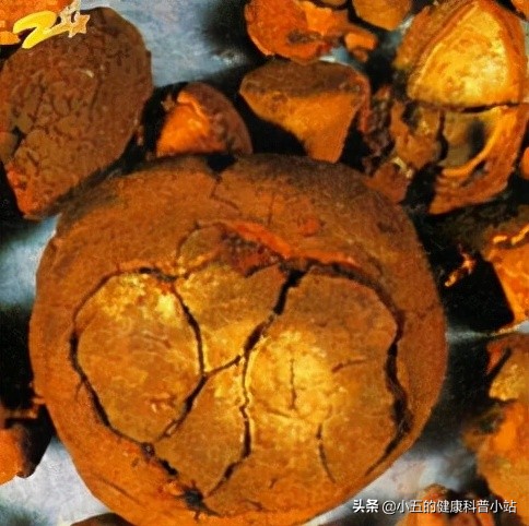 调理冠心病的中药方,调理冠心病中医讲座视频