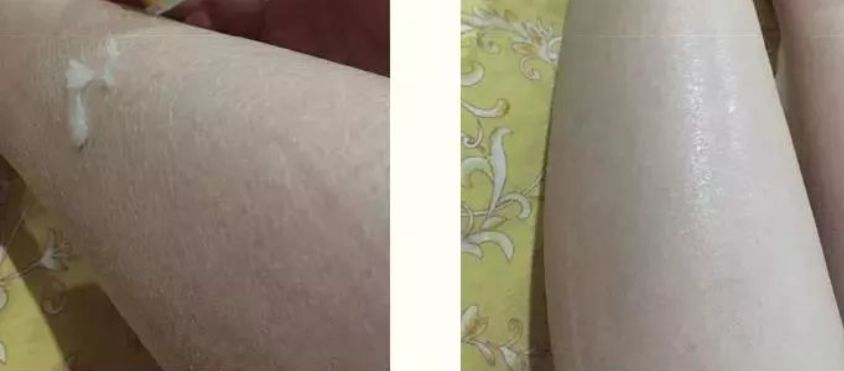 冬天脚跟干裂又起皮怎么办,冬天脚跟干裂起硬皮擦什么保湿好