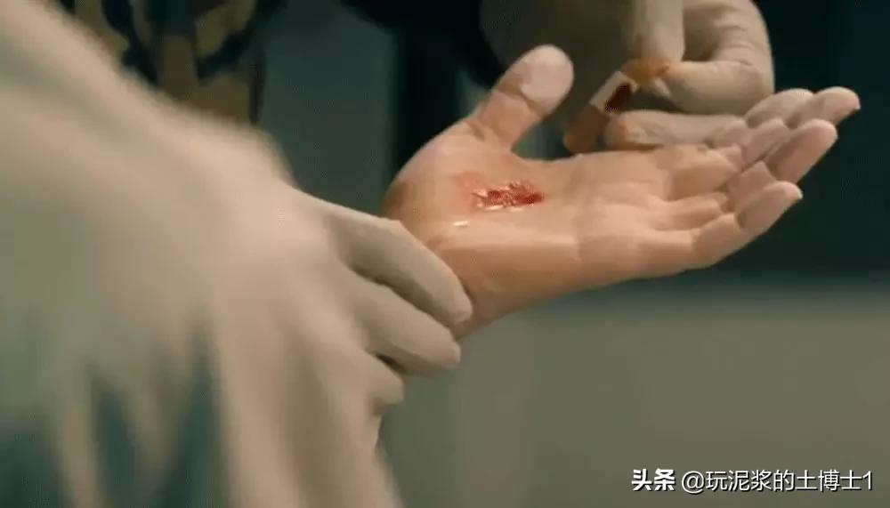 通过性传播艾滋病的条件,通过性传播的艾滋病人