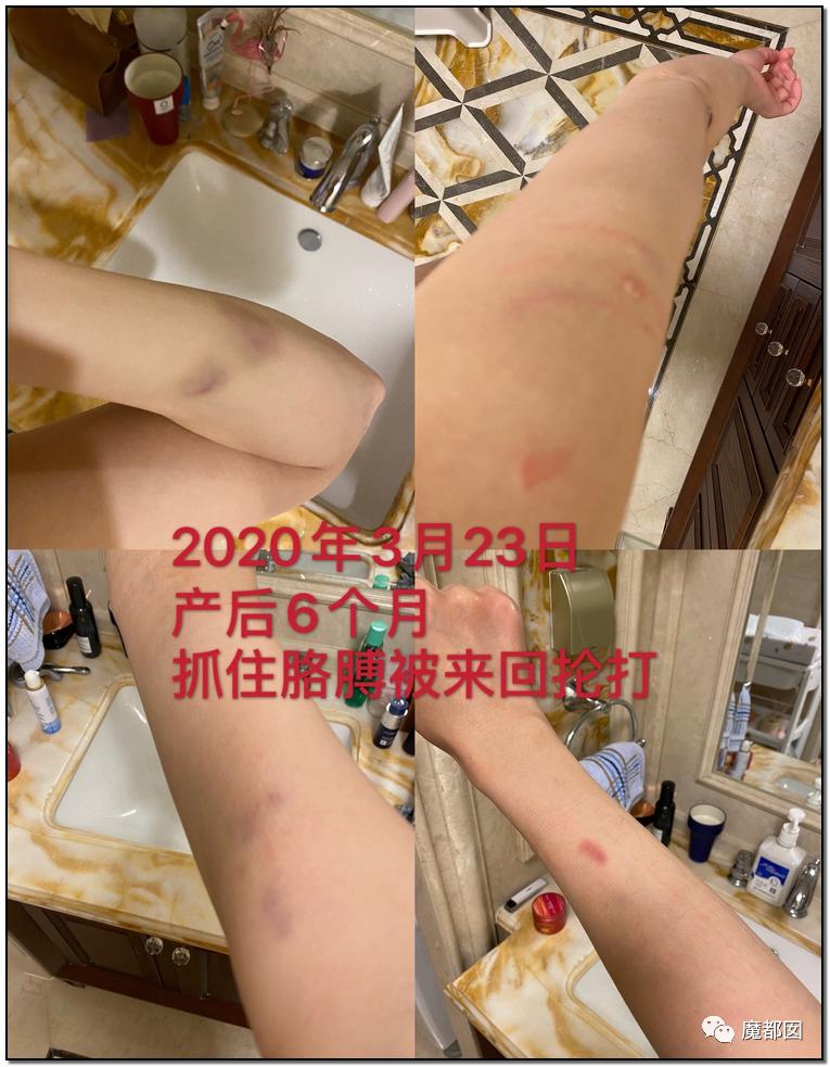 短跑名将张培萌家暴事件,短跑名将张培萌被控家暴