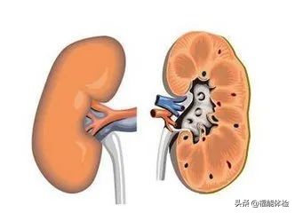 体检发现肾囊肿不要怕,体检肾囊肿要注意什么