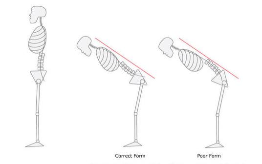 髋发力动作模式,髋骨疼痛的动作怎么练