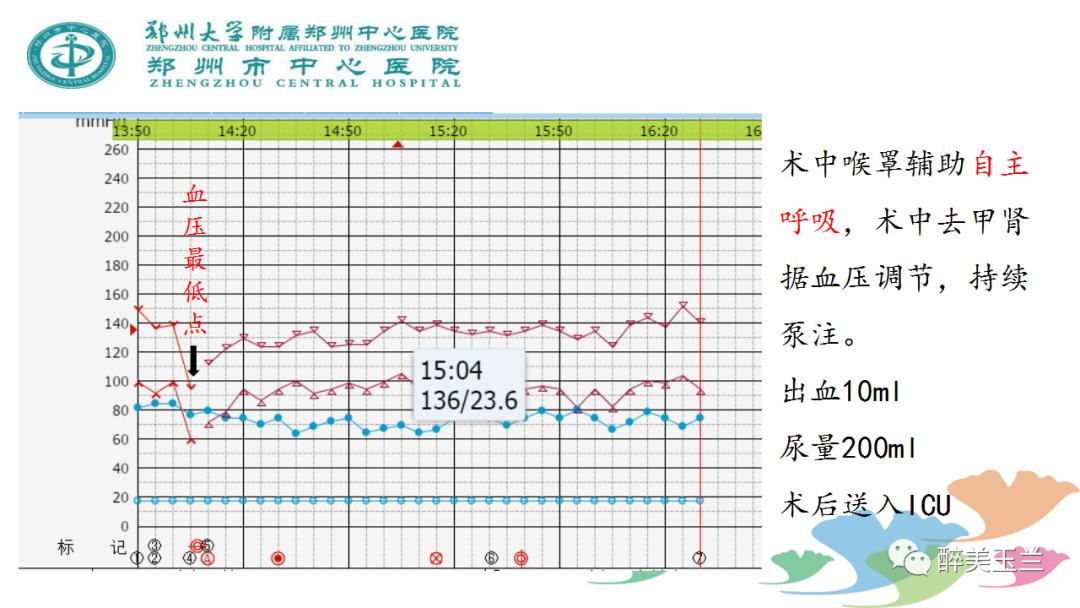 局麻药中毒的术前用药口诀,局麻药中毒临床表现及处理流程ppt