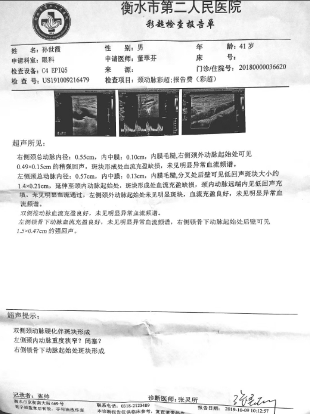 消斑块的秘方,祛血管斑块通络汤