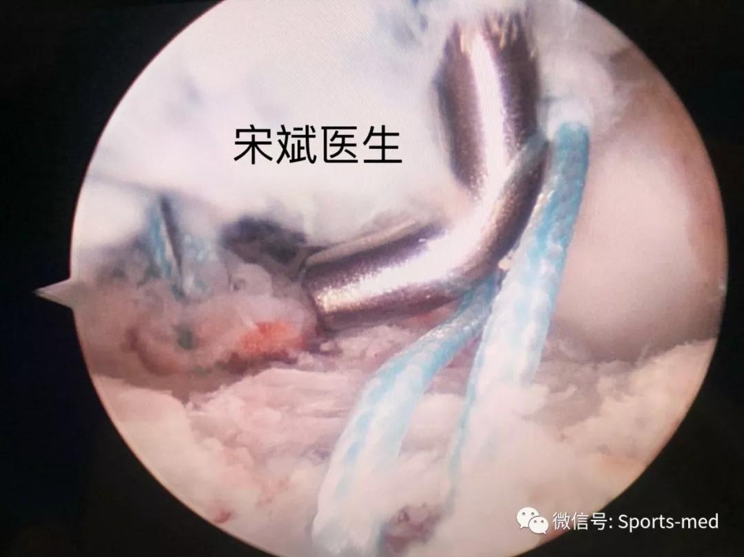 涓嶅ソ鎯圭殑浜虹殑涓夊ぇ鐗圭偣,涓夎闊у甫鎷夐暱