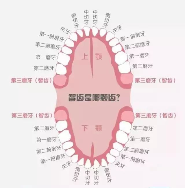 拔智齿真实过程无切口,拔智齿真实体验