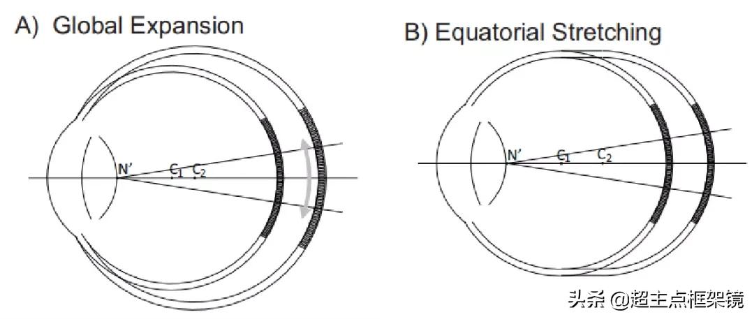 近视矫正仪器对儿童近视有用吗,儿童近视100度戴矫正镜有用吗