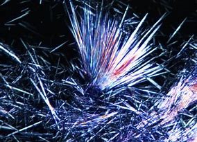 辟谣尿酸高就一定会引发痛风,辟谣痛风