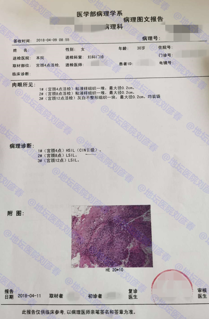 治疗hpv83最好的方法,hpv1247能自愈吗