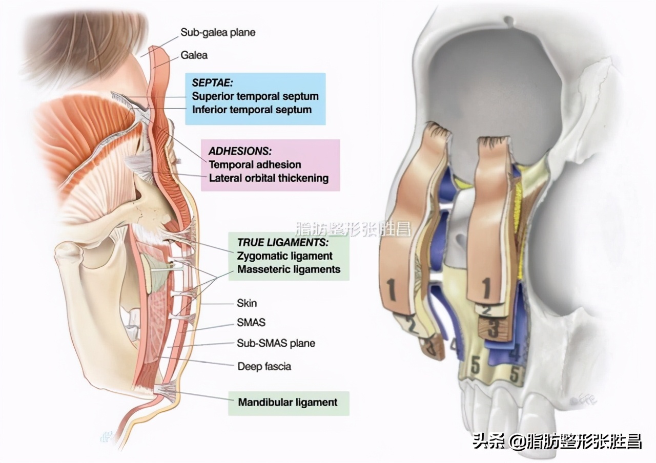 印第安纹部位出现皱纹,印第安皱纹怎么去除