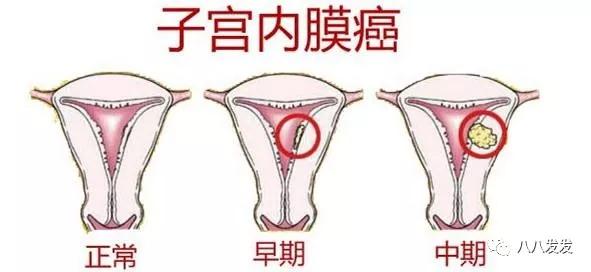 绝经期经血突然多,绝经后还来月经吃什么药