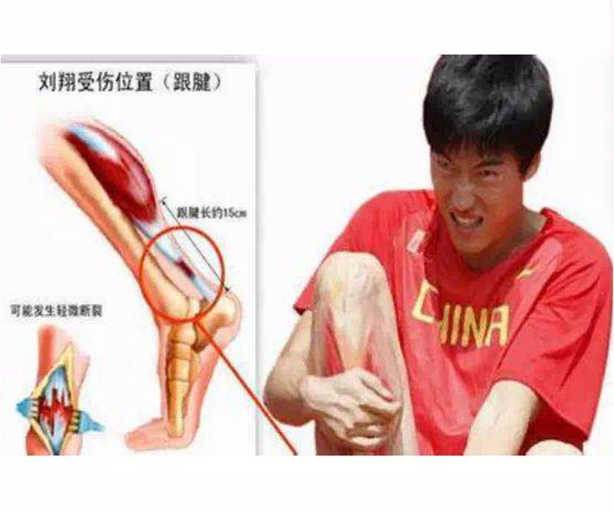 跟腱断裂怎么判断伤残,用什么方法判断跟腱断裂症状