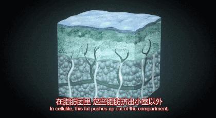 发胖脸上长痘痘是怎么回事,长痘发胖需要做激素六项