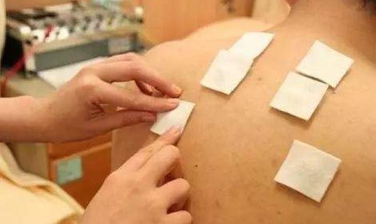 贴三伏贴起水泡是怎么回事,三伏贴起水泡为什么是黄色的