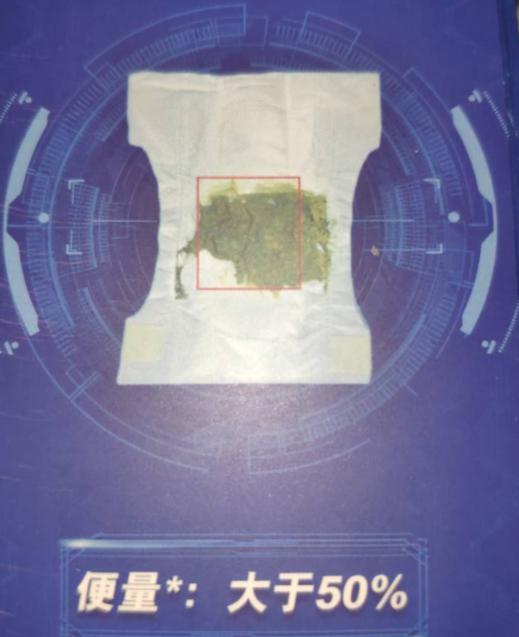 正常宝宝便便的颜色和形状,宝宝便便识别方法图解1岁